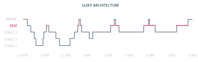 A diagram showing the different stages of sleep